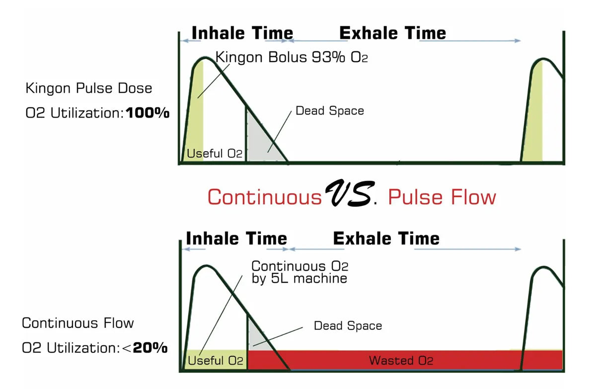 Smart Pulse-Dose Oxygen Supply